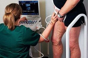 Diagnostické možnosti pre kŕčové žily na nohách