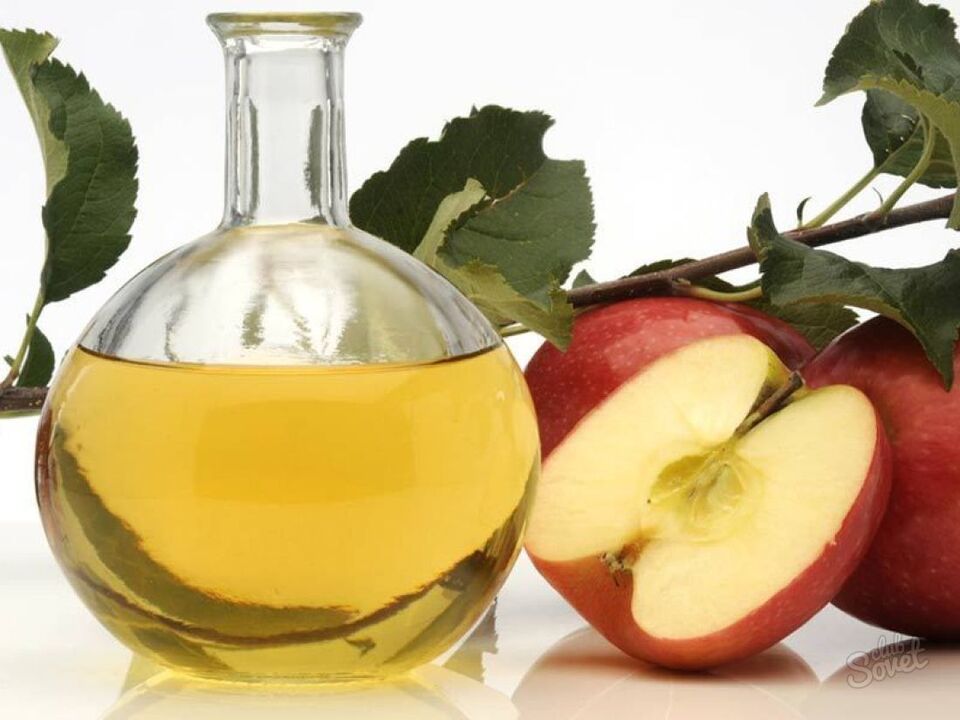 jablčný ocot na kŕčové žily